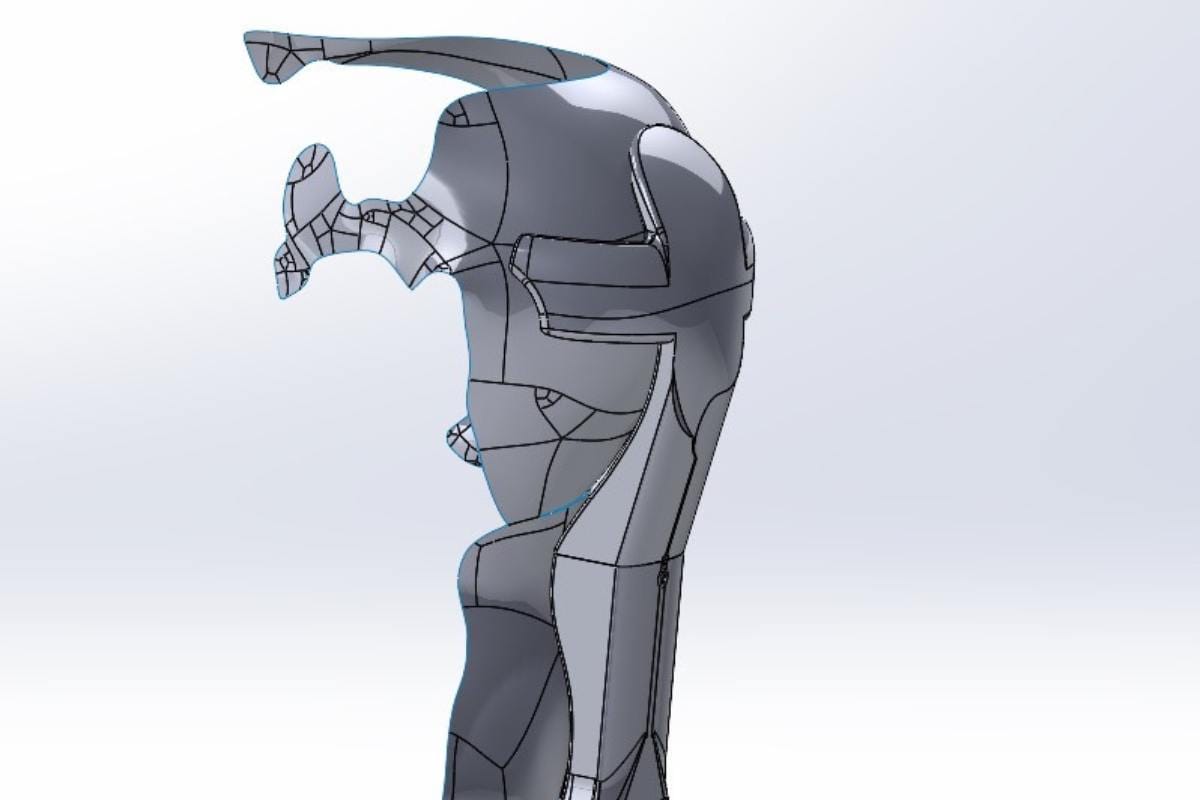 Historia real Impresión 3D Ortopedia en 3D Por Additium 3D -2