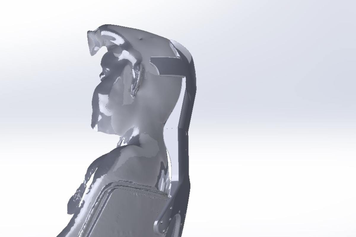 Historia real Impresión 3D Ortopedia en 3D Por Additium 3D -