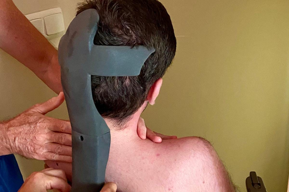 Historia real Impresión 3D Ortopedia en 3D Por Additium 3D -5