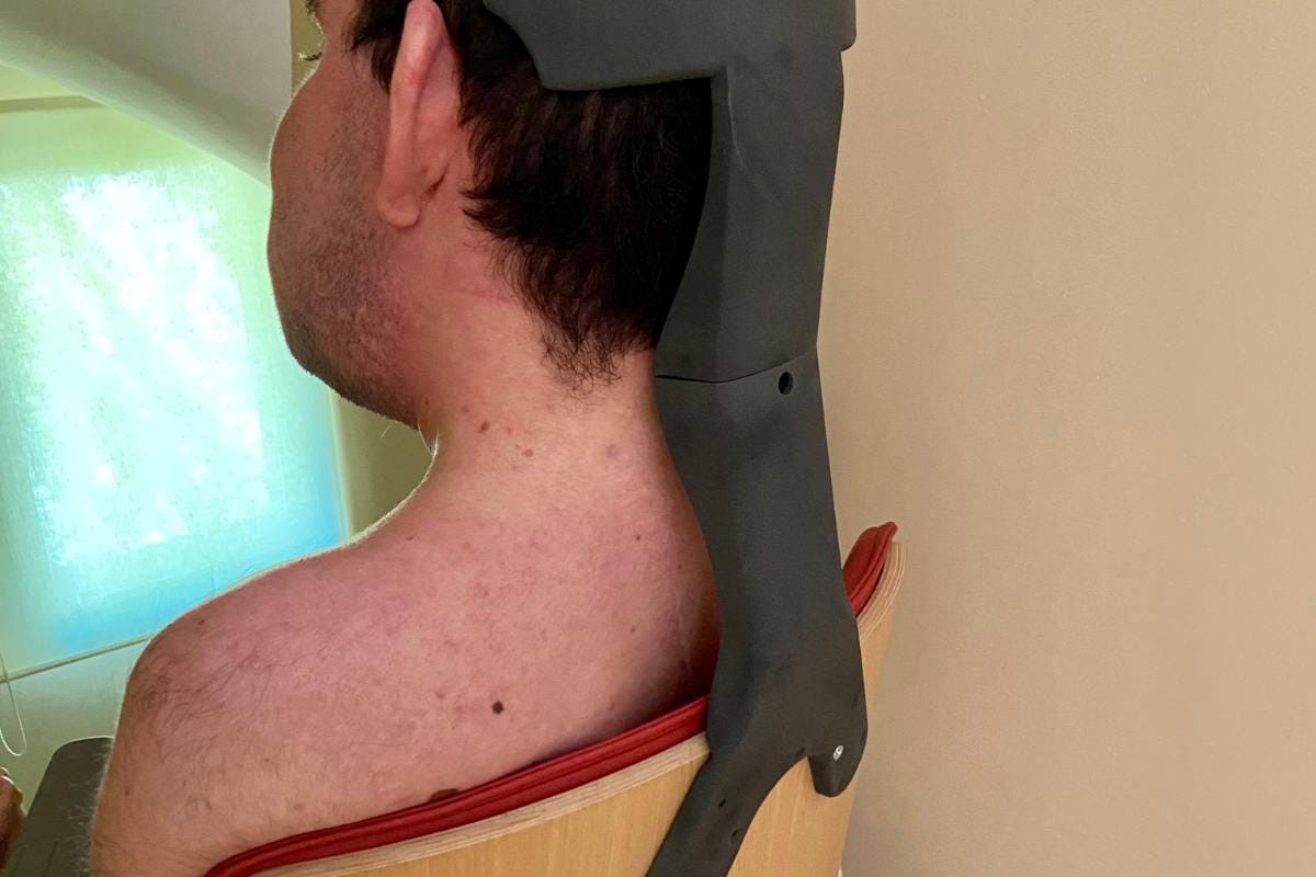 Historia real Impresión 3D Ortopedia en 3D Por Additium 3D -6