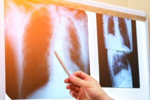 Órganos impresos en 3D y aplicaciones en la medicina
